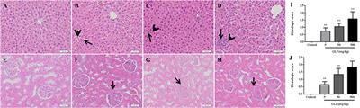 Ion Imbalance Is Involved in the Mechanisms of Liver Oxidative Damage in Rats Exposed to Glyphosate